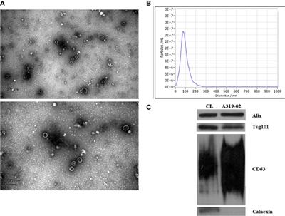 Characterization of lncRNA Profiles of Plasma-Derived Exosomes From Type 1 Diabetes Mellitus